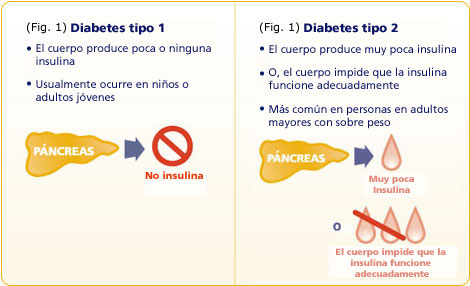 Recomendaciones dibetico tipo 1 cetosis